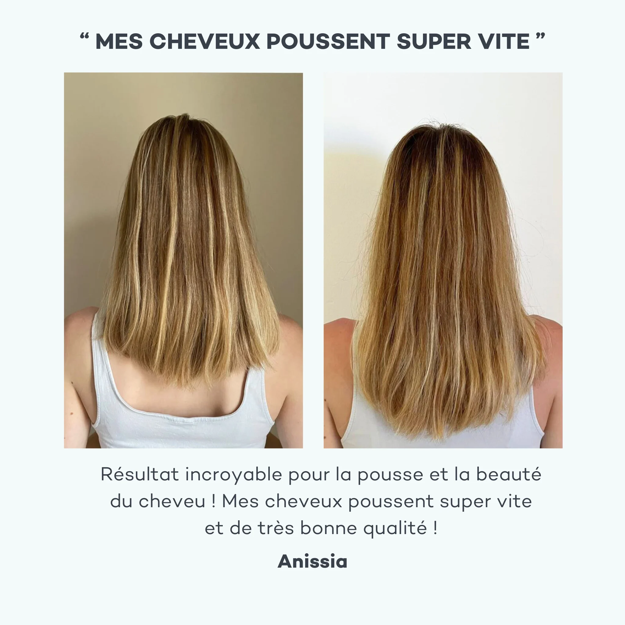 Complexe de Pousse - Image 5