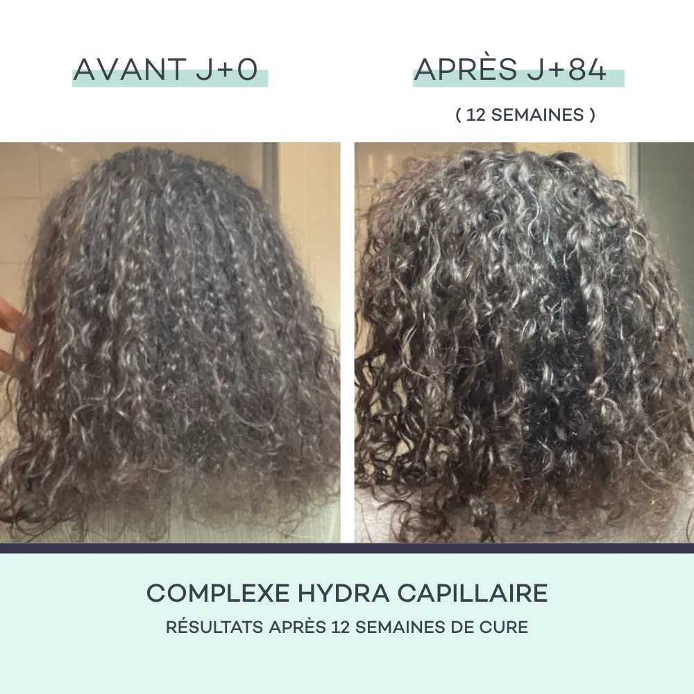 Complexe Hydra-Capillaire - Image 3