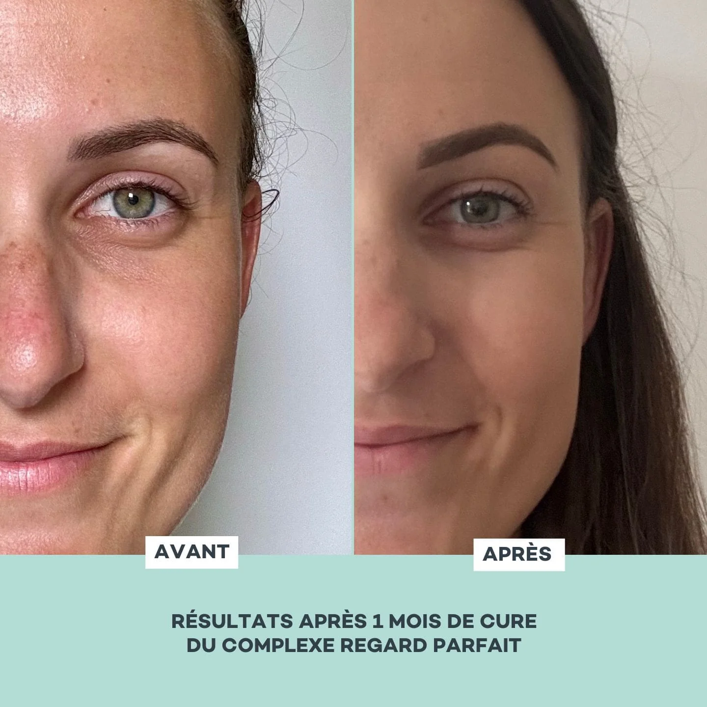Complexe Regard Parfait - Image 5