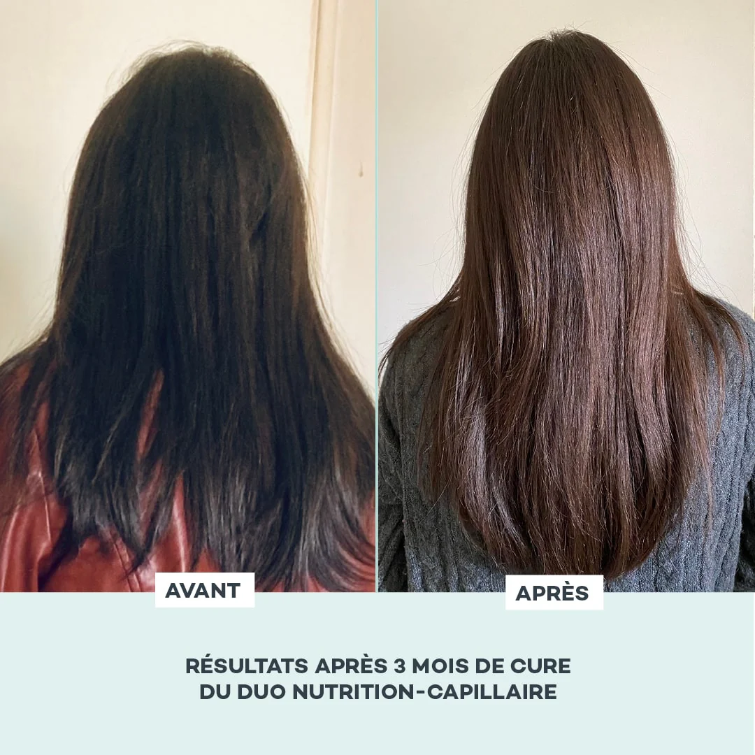 Hair Nutrition Duo - Image 6