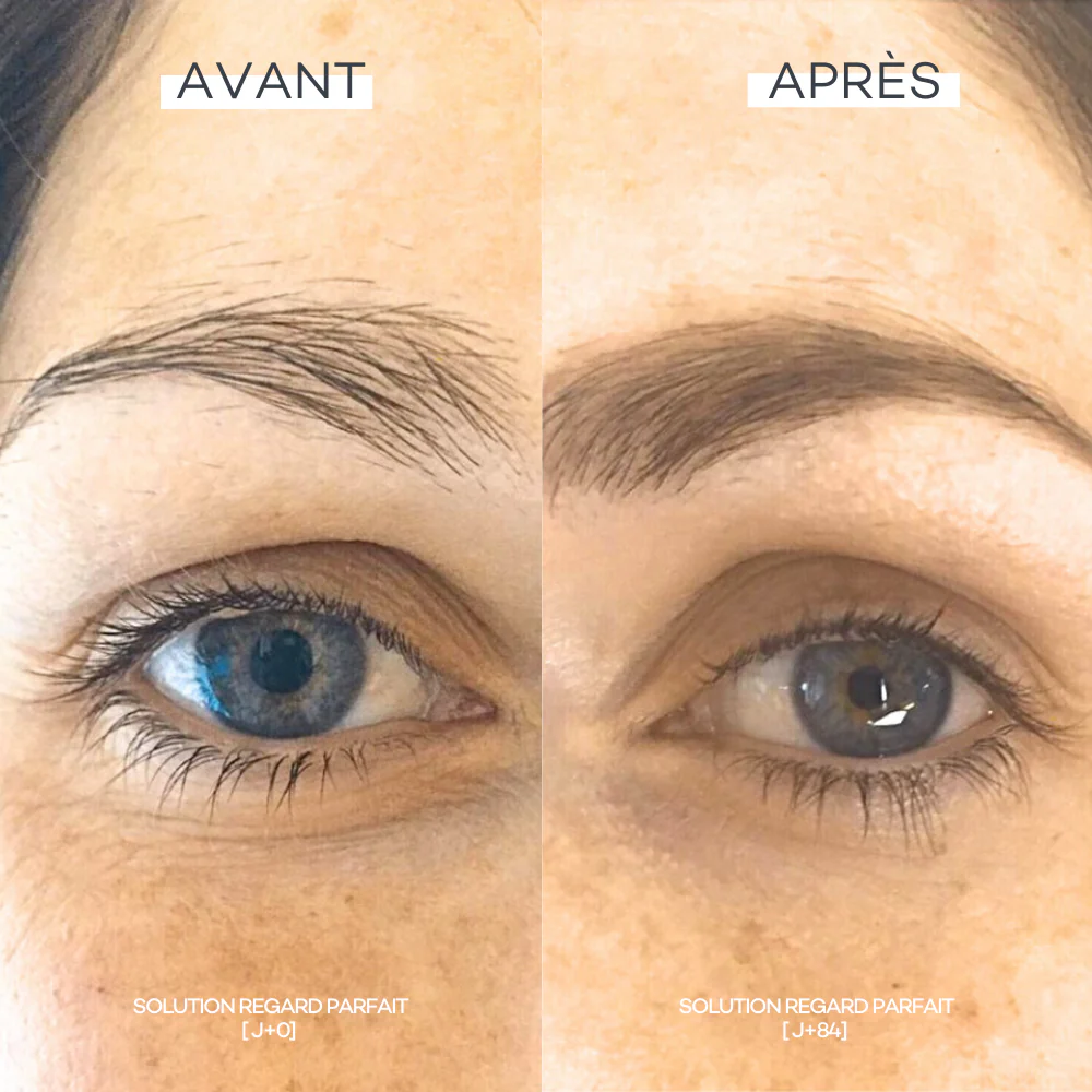 Perfect Eye Contour Solution - Image 5