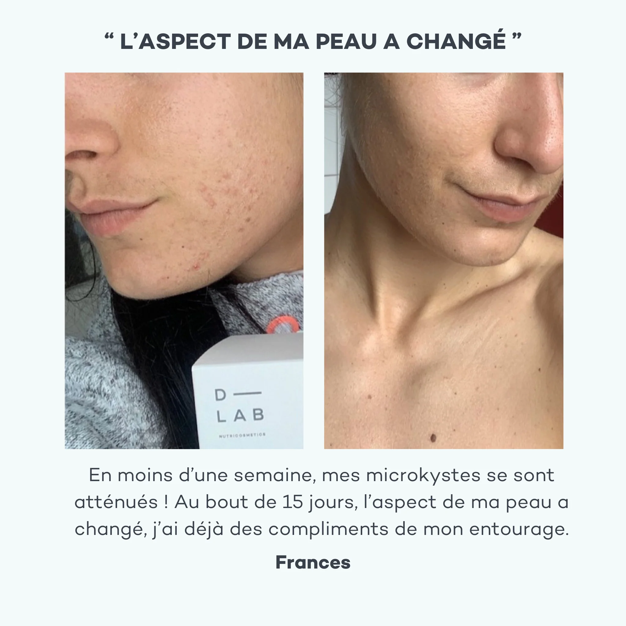 Perfect Skin Program - Image 6