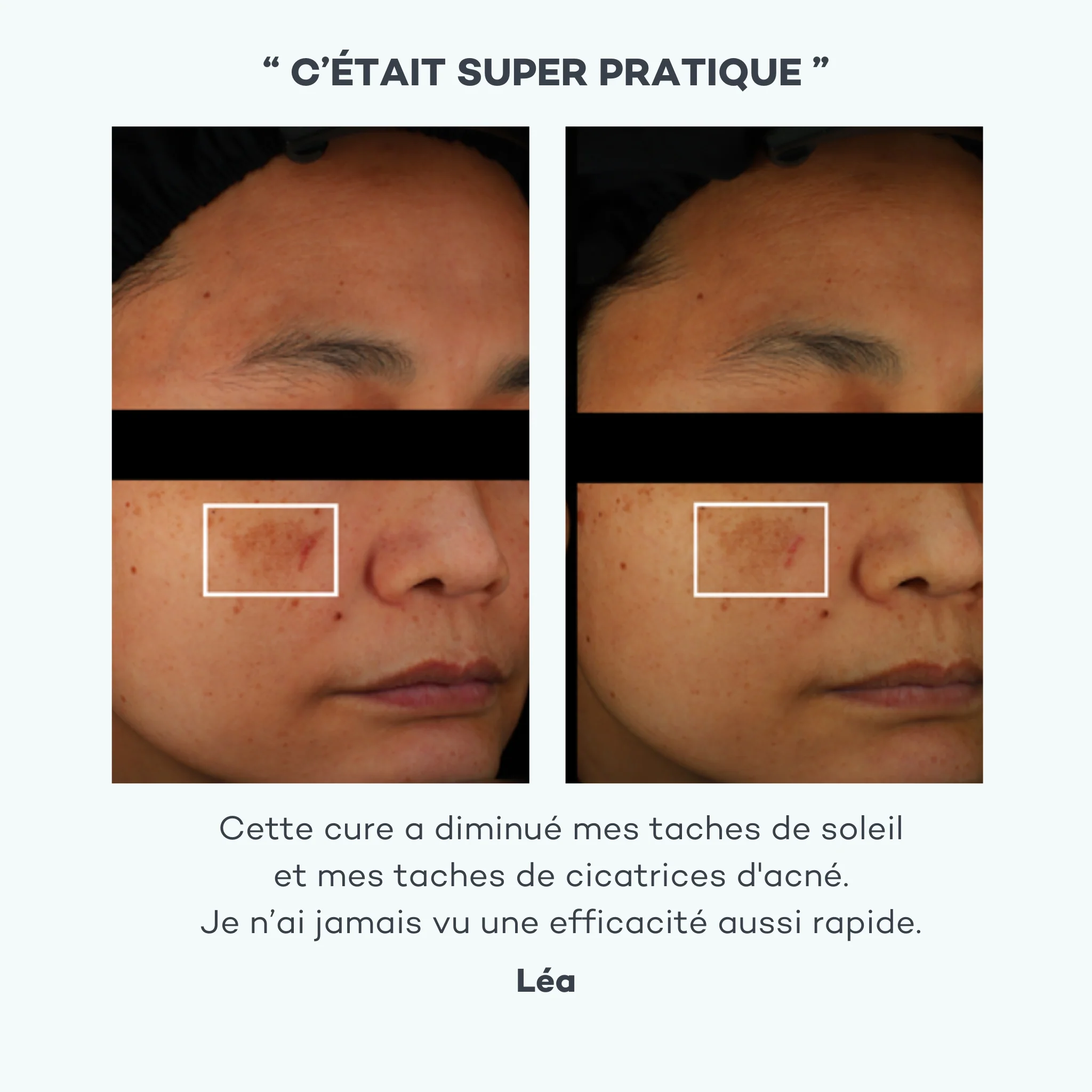 Dark Spot Solution 28 Shots - Image 3