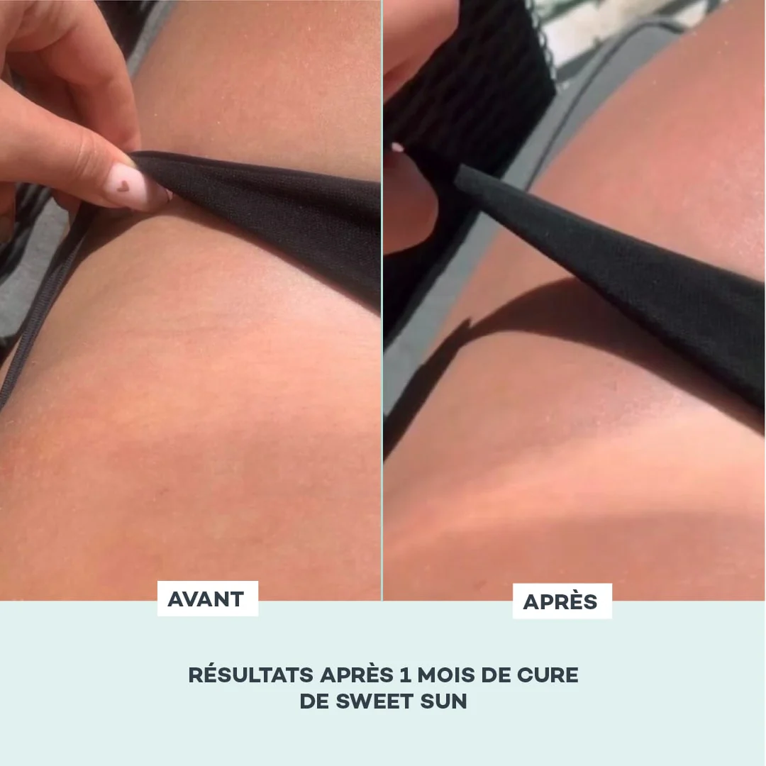 Gummies SOLAIRES - Image 4